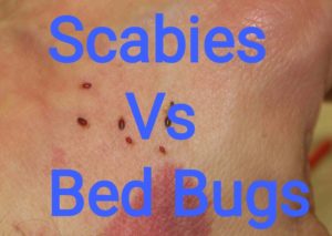 SCABIES VS BED BUGS